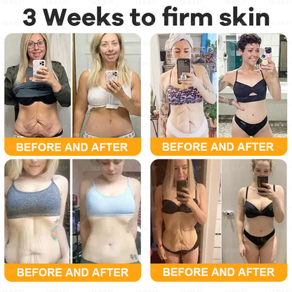 VLSVLS® Bee Venom Comprehensive Cream 💖💖LAST DAY 80% OFF (Sagging Skin, Fine Lines, Loss of Firmness, Flat Bust, Drooping Hips, and More)