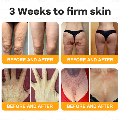 VLSVLS® Bee Venom Comprehensive Cream 💖💖LAST DAY 80% OFF (Sagging Skin, Fine Lines, Loss of Firmness, Flat Bust, Drooping Hips, and More)