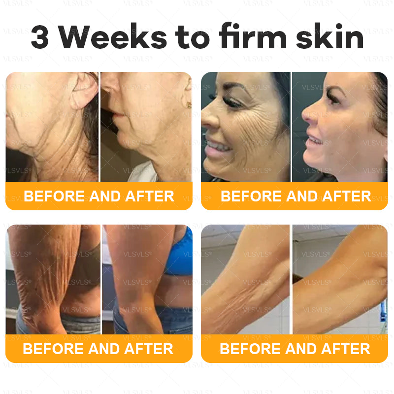 VLSVLS® Bee Venom Comprehensive Cream 💖💖LAST DAY 80% OFF (Sagging Skin, Fine Lines, Loss of Firmness, Flat Bust, Drooping Hips, and More)